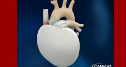 A fost inventată inima artificială A fost inventată inima artificială
