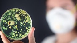 Trei cazuri GRAVE de infectare cu boala ȘOBOLANILOR, înregistrate în Republica Moldova Trei cazuri GRAVE de infectare cu boala ȘOBOLANILOR, înregistrate în Republica Moldova