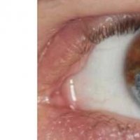 Cum Iţi Poţi Schimba Culoarea Ochilor Fără Lentile De Contact In