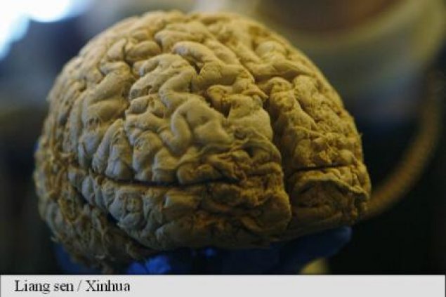 Creierul și chimia corpului - Constantin Țîbîrnă, NUtriționist-Dietetcian