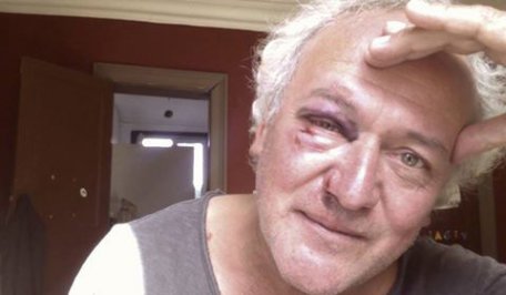 Scriitor român, bătut de țigani la Bruxelles: „Tânjeau la sacul meu cu computerul” Scriitor român, bătut de țigani la Bruxelles: „Tânjeau la sacul meu cu computerul”