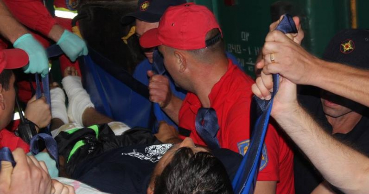 Cumpărare de cultură în Kaluga umflarea articulației genunchiului și nu se îndoaie