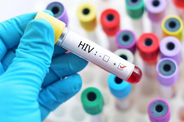„Cum recunoști semnele precoce ale HIV / SIDA și nu pierzi începutul?” - Infecţii June